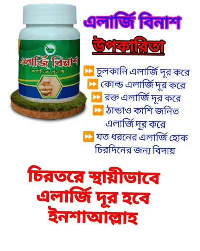 এলার্জি বিনাশ